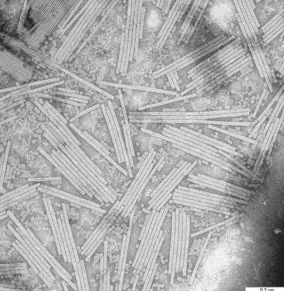 Foto della struttura dei virus del mosaico del tabacco di Rosalind Franklin